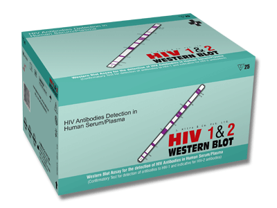 J Mitra HIV 1& 2 Western Blot